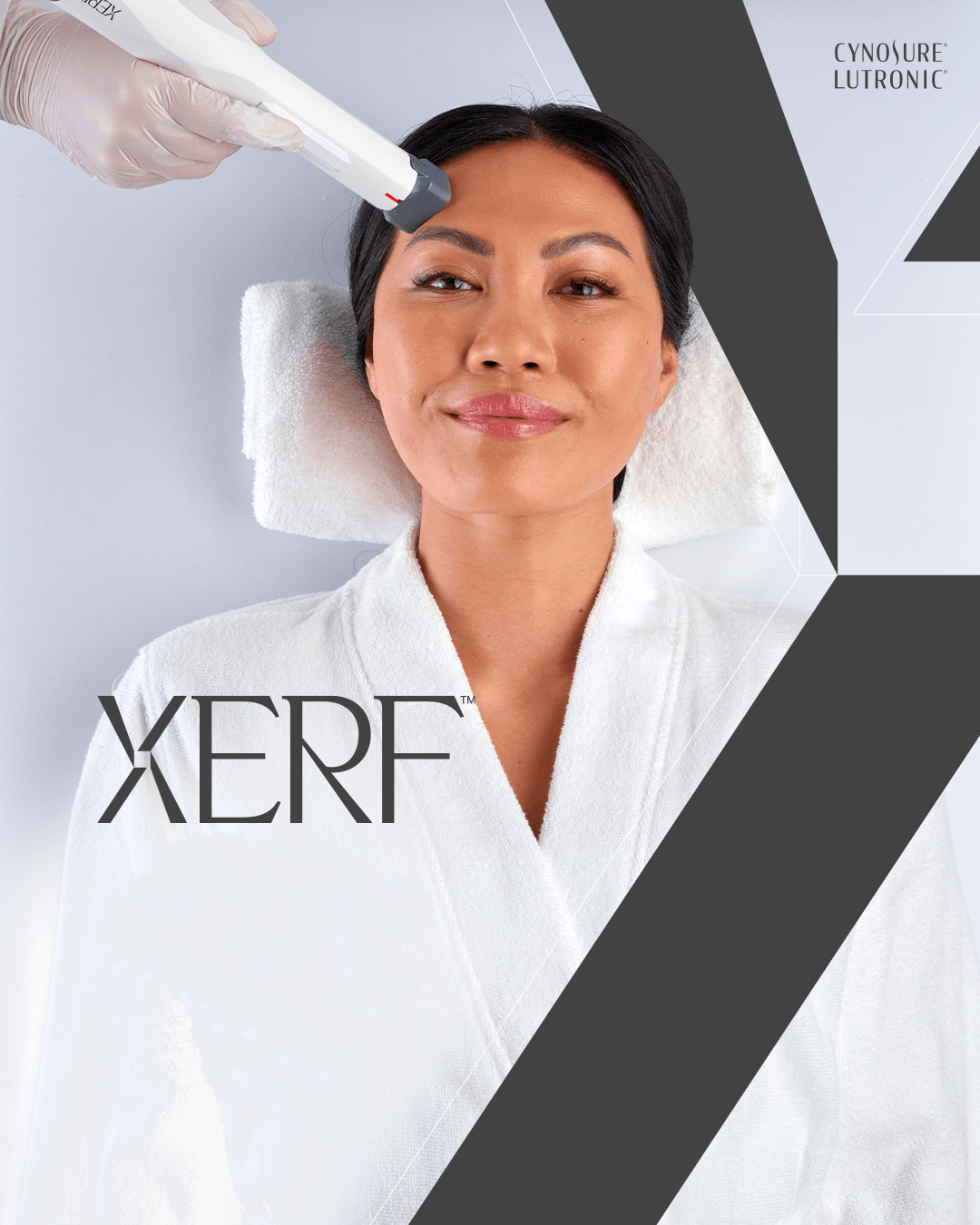 XERF results without sacrifice: no needles, no numbing, no downtime